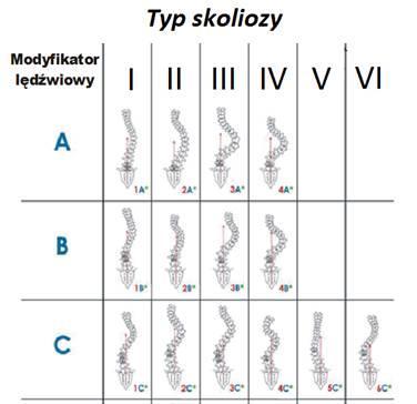 Typy skoliozy