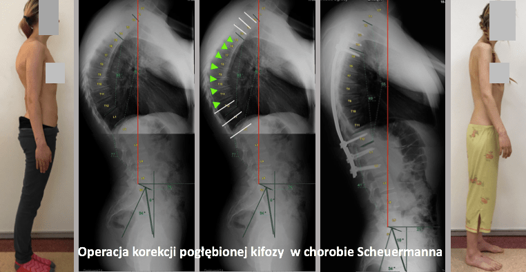 leczenie operacyjne 9