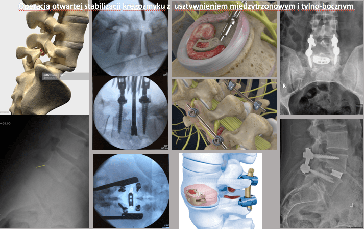 leczenie operacyjne 15